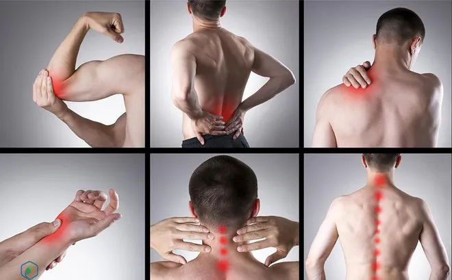 Cách phòng ngừa các bệnh lý xương khớp thường gặp vào mùa mưa 2 Ảnh minh họa bệnh thoái hóa khớp
