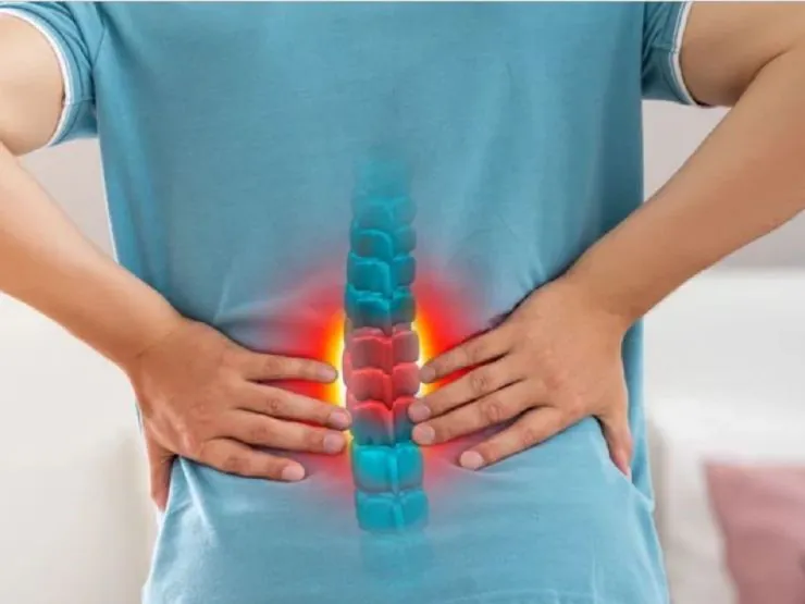 Cách phòng ngừa các bệnh lý xương khớp thường gặp vào mùa mưa 4 Ảnh minh họa bệnh đau lưng