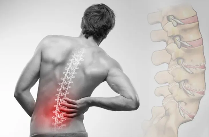 Các bệnh xương khớp phổ biến ở người trên 40 tuổi 2 dau lung 7286
