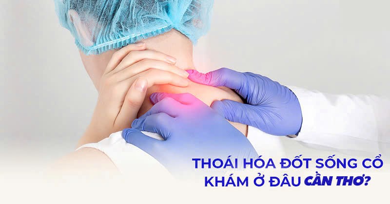Thoái hóa đốt sống cổ: Làm sao để điều trị dứt điểm và phòng ngừa tái phát? 1 81