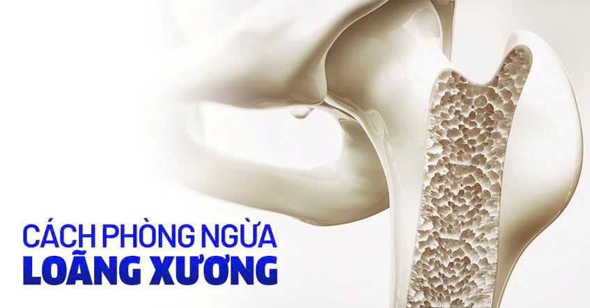 Những lưu ý quan trọng trong phòng ngừa loãng xương 1 phòng ngừa loãng xương
